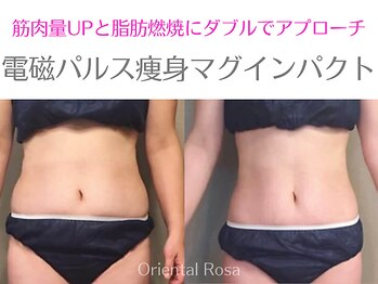 オリエンタルローザ 表参道(Oriental Rosa)/電磁パルス痩身マグインパクト◎