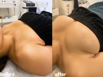 エムプリュ 心斎橋店(M.plus)/定着がすごい！！