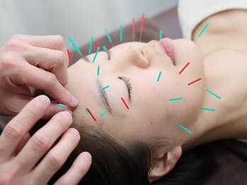 ふらみんご鍼灸整骨院の写真/むくみ・ほうれい線・たるみでお悩みの方に！ハリ感や弾力をもたらす施術で内側から美しく☆