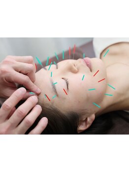 鍼灸施術を受けたい