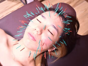 鍼屋フミ(鍼屋FUMI)の写真/【南柏唯一の完全個室プライベート鍼灸サロン】こんなに変わる!?感動の肌質改善&美肌へと育む美容鍼に特化!