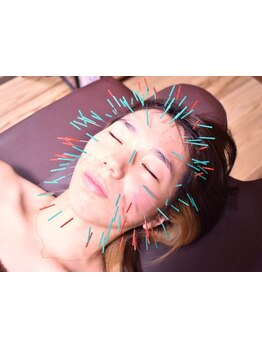 鍼灸施術を受けたい