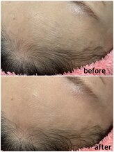 アンベリィ(Embellir)/フェイシャルwax