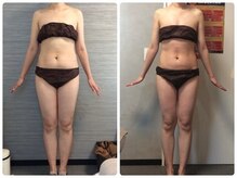 ウェリナ平和堂長久手院/小顔矯正/骨盤矯正/美脚サロン