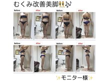 エステティック レイビス 川崎店(RAYVIS)/