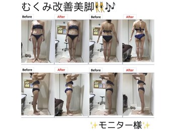 エステティック レイビス 川崎店(RAYVIS)/