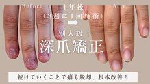 ヴェールリム(verl lim)