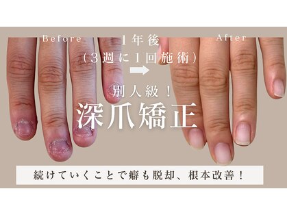 ヴェールリム(verl lim)の写真