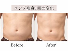 ソウ 明大前(SOU)の雰囲気（男性施術者常駐！メンズのダイエットもお任せください）