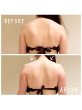 デジール(DESIR)/before&after