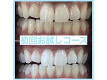 プラチナムビューティー 名古屋栄本店(PLATINUM BEAUTY)/【Before⇒After】