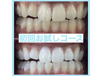 プラチナムビューティー 名古屋栄本店(PLATINUM BEAUTY)/【Before⇒After】