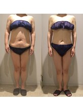 アユアランリンク 札幌中島公園店/E様：40代！12か月で‐13Kg！