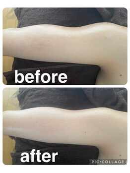 ギンザアール(GINZA R.)/ほっそり二の腕に♪