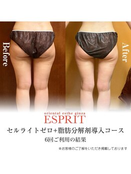 エスプリ 銀座店/痩身銀座・スラリ足・きれいな足
