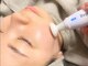 レユシール(reussir cosmetic salon)の写真/【NEWOPEN】話題の“プラズマフェイシャル”で変わる肌印象。クリアで滑らかな理想の素肌を貴方のものに◆