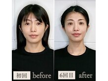 マナレア 湘南(Manalea)の雰囲気（【小顔矯正】顔の大きさ、面長、エラ、たるみ、シワにお悩みの方）