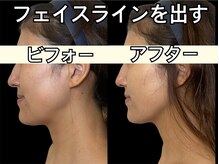 ココ(COCO)/顔の厚みをなくして体積を小さく