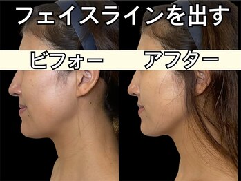 ココ(COCO)/顔の厚みをなくして体積を小さく