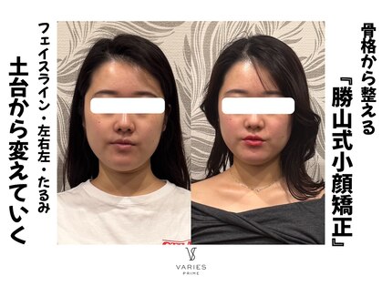 ヴァリエス プライム 中目黒店(VARIES PRIME)の写真