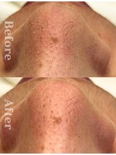 ディレイア ザ コスメ 有楽町マルイ店(direia the cosme)&nbsp;40代 (女性)