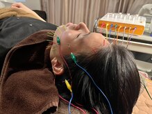 ヘッドサイエンス(HEADSCIENCE)/疲れ顔には電気鍼がオススメ！