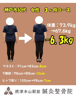 摂津本山駅前鍼灸整骨院/50代女性