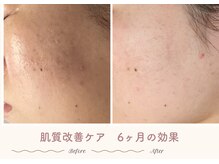 エステティックサロン シーズ/滑らかなはだに♪