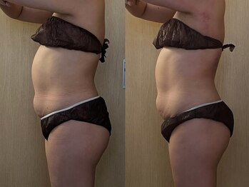 マイティー整骨院 ココア(CoCoa)/セルクラ