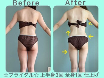 ビーナイス ビューティー(Be Nice Beauty)/細身→引き締め★姿勢改善★