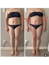 ティアラ(TIARA)/痩身　ウルトランスフォーマー