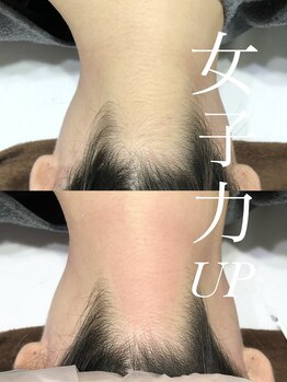 アイラッシュサロン ウェリナ 名古屋(Welina)/敏感肌/うなじ/脱毛/ワックス