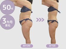 ビップ 赤坂店(Bipp!)の雰囲気（40代から専門ダイエットサロン/無理なくしっかり結果に繋げます）