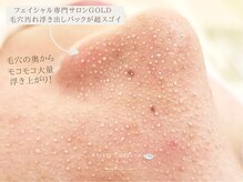 ゴールド 栄店(GOLD)の雰囲気（ＧＯＬＤの毛穴洗浄パックで浮き上がってきた【毛穴汚れ】です！）