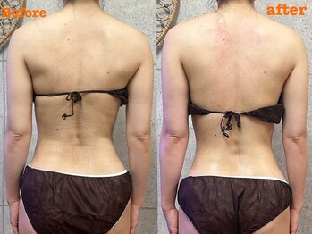 エイミー(eimy_)/全身リンパマッサージ