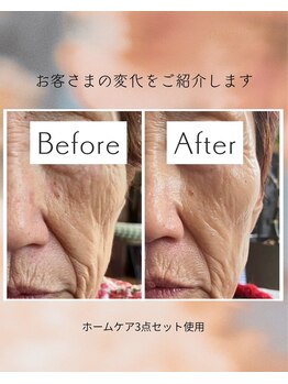 レジュイール(Rejouir)/