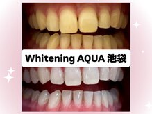 アクア 池袋店(AQUA)の雰囲気（ホワイトニングが初めての方も安心◎丁寧なカウンセリング）