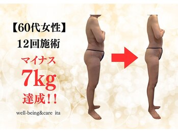 イタ 岡崎店(ita)/【　ビフォーアフター　】