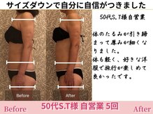 アメリイ 百合ヶ丘 新百合ヶ丘(Amerii)/【50代痩身】5回二の腕お腹お尻