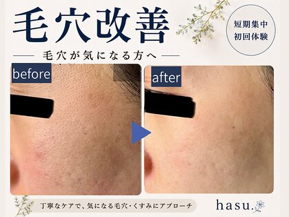 ハス(hasu.)の写真