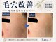 ハス(hasu.)の写真