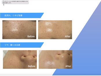 アンドソイル(&SOIL)の写真/【韓国No1ピーリング】セラピール
