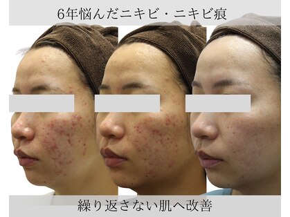 エピア 半田店(Epia)の写真