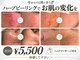 プリュボーテ(Pul Beaute)の写真