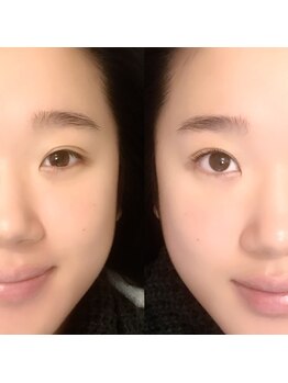 ラッシュガーデン(Lash Garden)/潤い美まつげパーマ