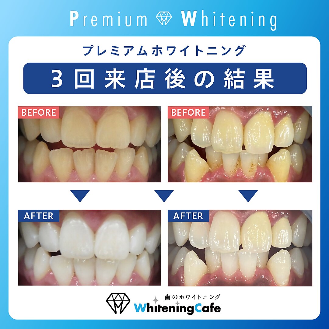 ホワイトニングカフェ イオン新潟青山店(WhiteningCafe