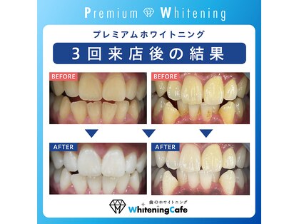 ホワイトニングカフェ イオン新潟青山店(WhiteningCafe)の写真