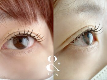 ムニ(muni)/&healthy【アンドヘルシー】