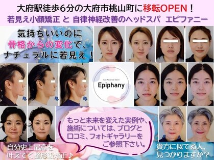 エピファニー(Epiphany)の写真