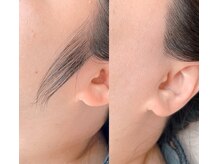 リリー(Lily)/もみあげワックス脱毛